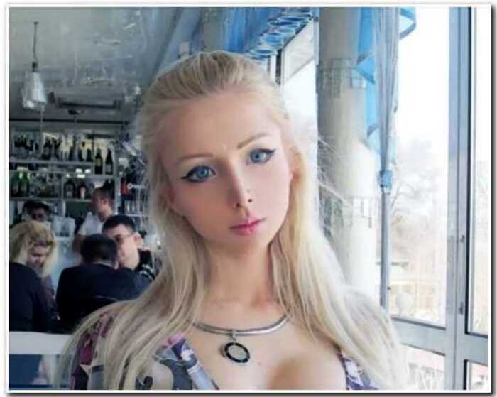 Из человека в куколку: устрашающие фото о том, как сейчас выглядит «Одесская Барби»