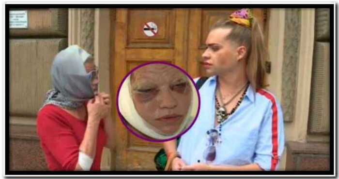 Гоген Солнцев скрывает лицо 63-летней жены после операции