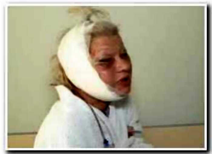 Гоген Солнцев скрывает лицо 63-летней жены после операции