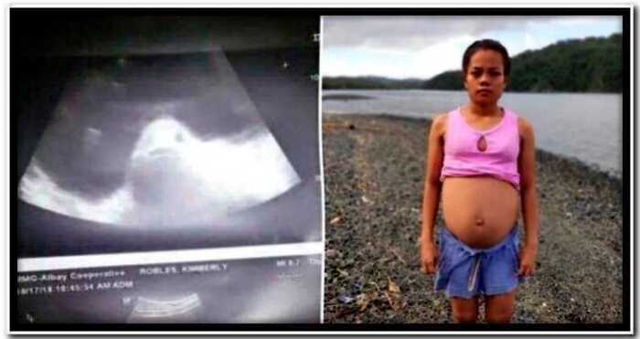 Жители Филиппинской деревни уверены — их  17-летняя землячка беременна рыбой