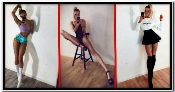 Девушка из Швеции покоряет Инстаграм благодаря своим аномальным ногам