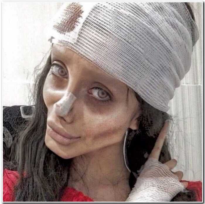 «Иранская Джоли» сделала 50 операций, чтобы стать похожей на своего кумира
