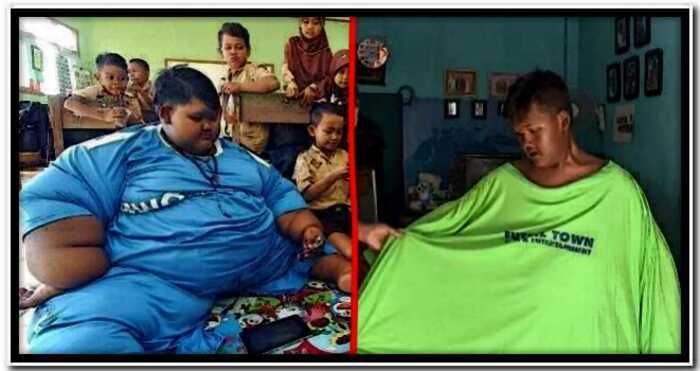 «В борьбе за жизнь»: самый толстый мальчик в мире сбросил половину собственного веса