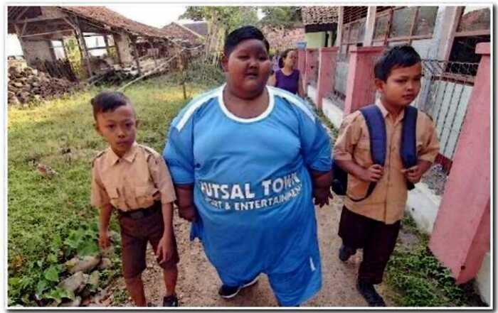 «В борьбе за жизнь»: самый толстый мальчик в мире сбросил половину собственного веса