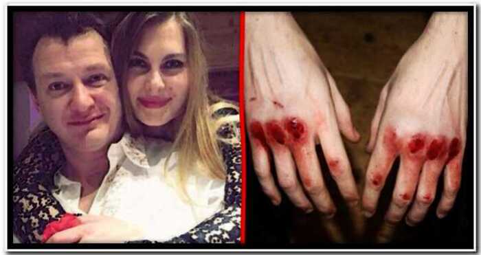 «Опять двацать пять»: Марат Башаров побил новую жену, сломав ей нос