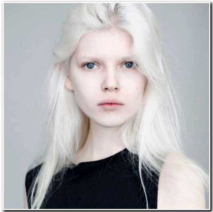 15+ интересных фото о том, как выглядят альбиносы разных национальностей