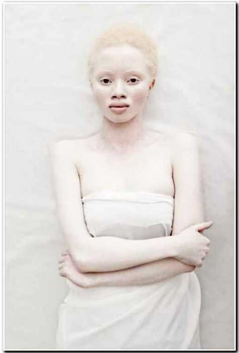 15+ интересных фото о том, как выглядят альбиносы разных национальностей