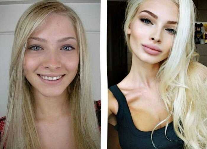 «Из человека в куклу»: 10 российских красавиц до и после пластики