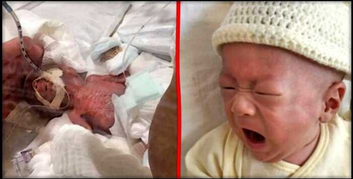 “Живое чудо”: в Японии выходили самого крошечного малыша в мире весом в 268 граммов