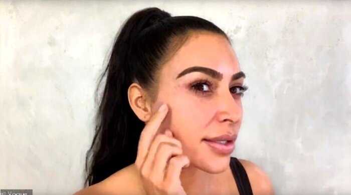 «Обычный человек»: Ким Кардашьян показала лицо, пораженное псориазом