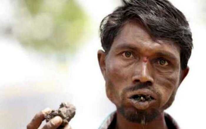 “Пожиратель кирпичей”: мужчина в Индии съел 5 тонн камней и не может объяснить зачем