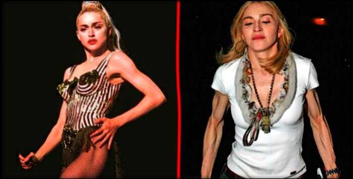“Бумеранг природы”: как тело Мадонны наказало ее за годы диет и колоссальных нагрузок