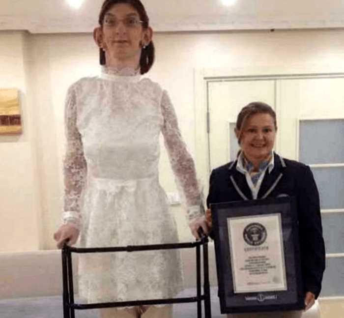 Самая высокая девушка в мире поделилась о сложностях в своей жизни