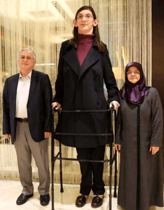 Самая высокая девушка в мире поделилась о сложностях в своей жизни