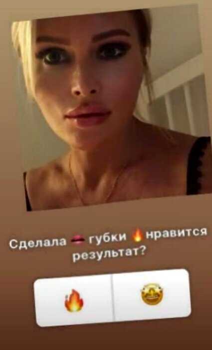Дана Борисова увеличила себе губы по бартеру за рекламу на страничке