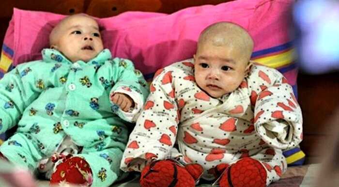 «Уникальный случай»: в Китае родились близняшки… от разных отцов!