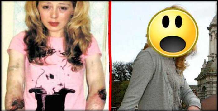 Британка, ставшая зависимой в 13 лет, показала фотографии до и после выздоровления