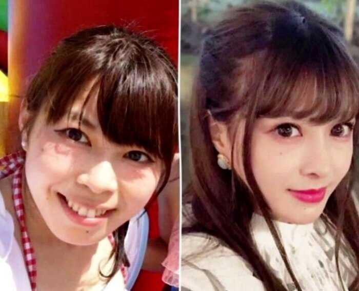 Японка показала, как пластические хирурги превратили ее из обычной девушки в героиню анимэ