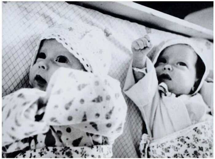 Как сложилась судьба первых удачно разделенных сиамских близнецов в СССР