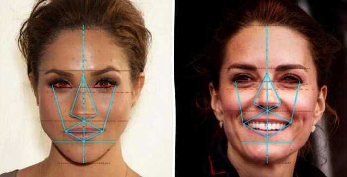 “Меган Маркл vs. Кейт Миддлтон”: Пластический хирург проанализировал, чье лицо красивей