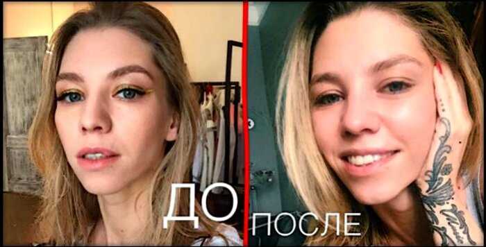 Дочь Ирины Салтыковой сделала пластику после укуса овчарке