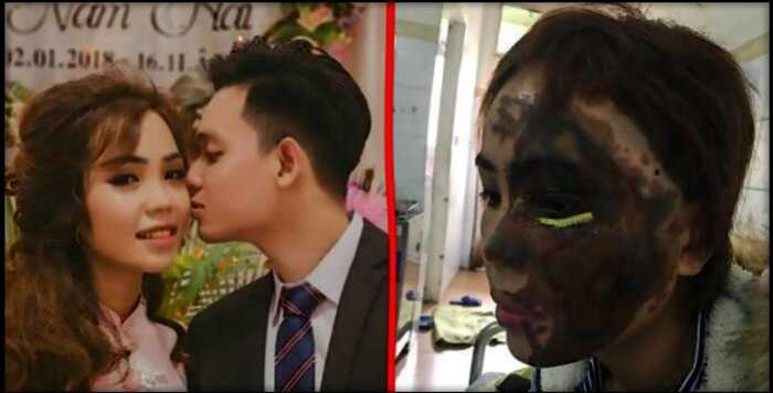 «Будешь такой навсегда»: Вьетнамец накануне свадьбы облил невесту кислотой
