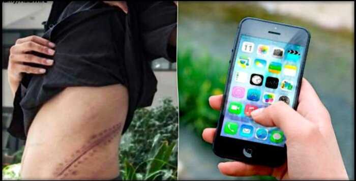 Китаец, продавший почку ради iPhone 4, теперь прикован к постели на всю жизнь