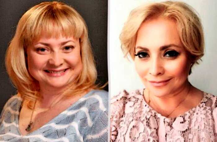«Долой тройной подбородок»: как изменились лица российских звёзд после похудения
