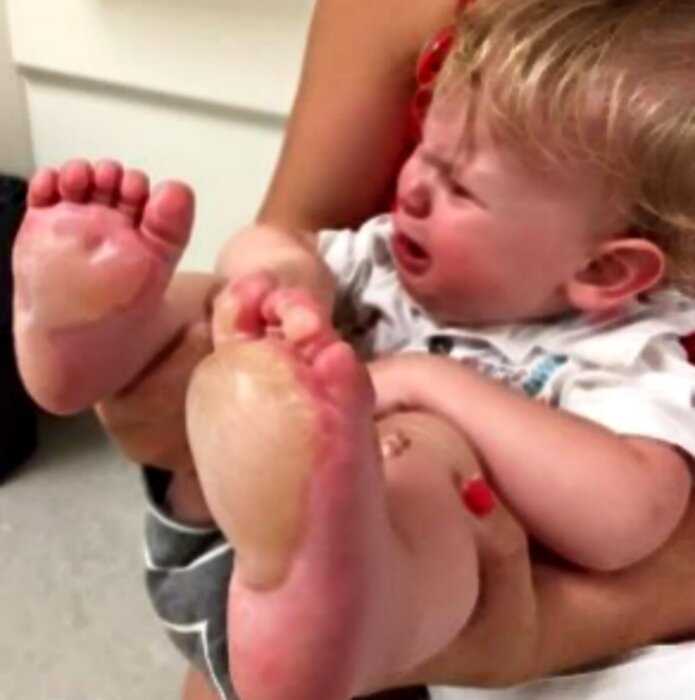 В Америке няня обожгла ноги ребенка за то, что тот &#8243;слишком много&#8243; плакал