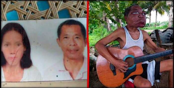 Филиппинский плотник однажды проснулся с лицом, которое изменило его жизнь навсегда