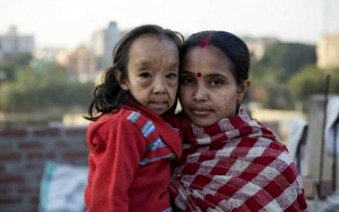 «Дети-старики»: загадочный феномен поразил всех малышей индийской семьи