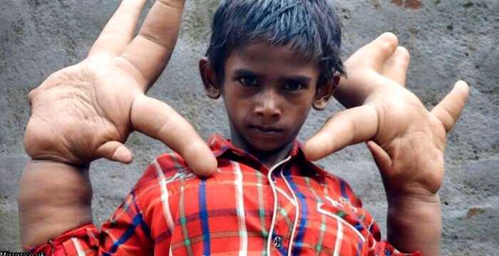 Директор индийской школы выгнал мальчика из школы из-за его рук