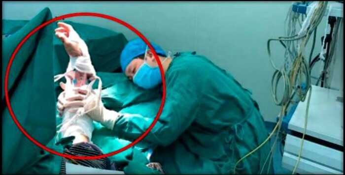 Фото китайского хирурга, уснувшего за операционным столом вызвало восхищение