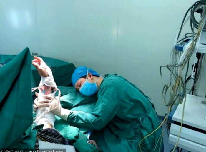 Фото китайского хирурга, уснувшего за операционным столом вызвало восхищение