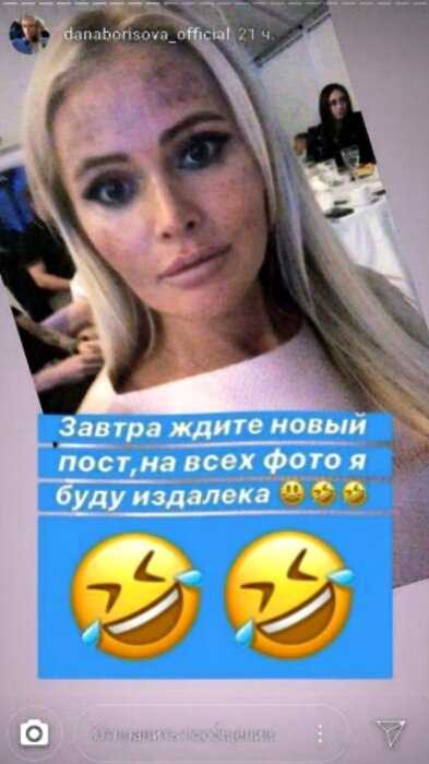 «Лицо со скидкой»: Дана Борисова изуродовала лицо дешевыми процедурами