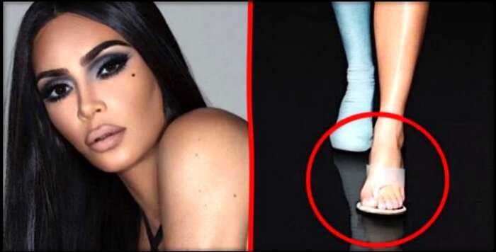 «Не такая уж идеальная»: у Ким Кардашьян нашли шестой палец на ноге
