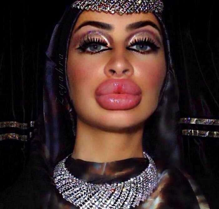 Афганская девушка пошла против традиций и сделала себе огромные губы
