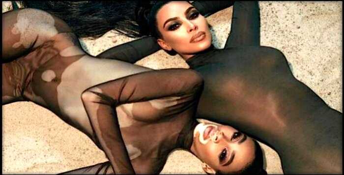 Ким Кардашьян выбрала лицом своего бренда необычную «пятнистую» девушку