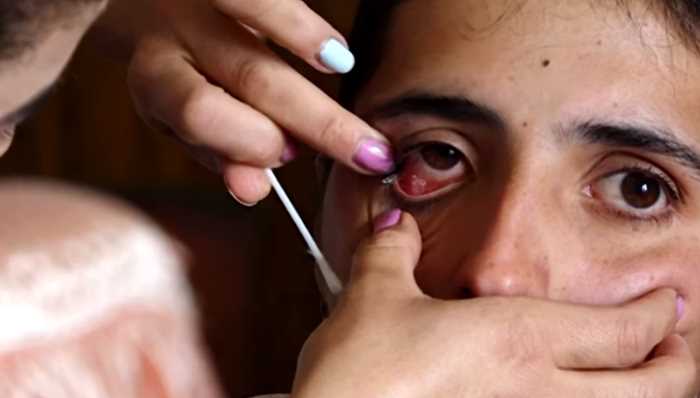 Плачущая кристаллами армянская девушка поставила врачей в тупик