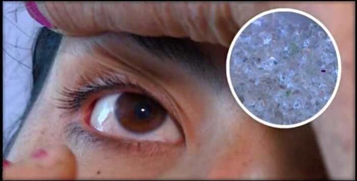 Плачущая кристаллами армянская девушка поставила врачей в тупик