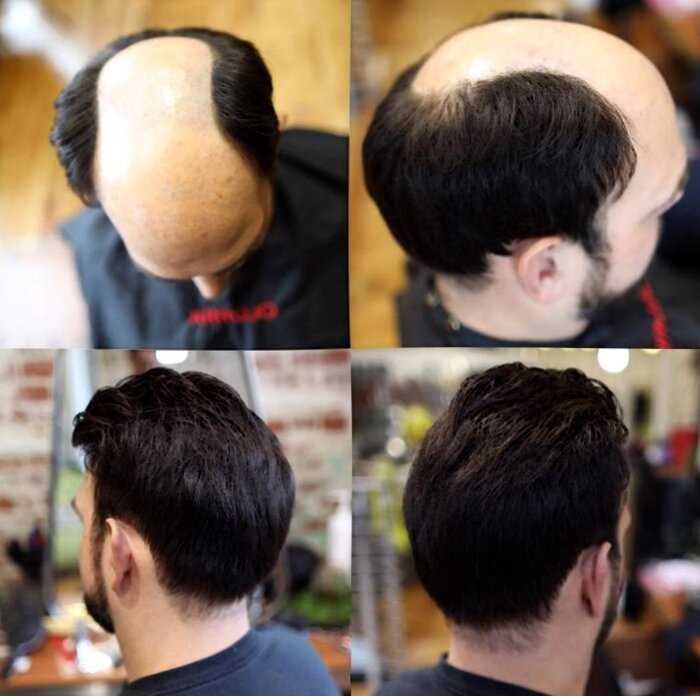 Парикмахер-волшебник превращает лысины мужчин в шикарные причёски