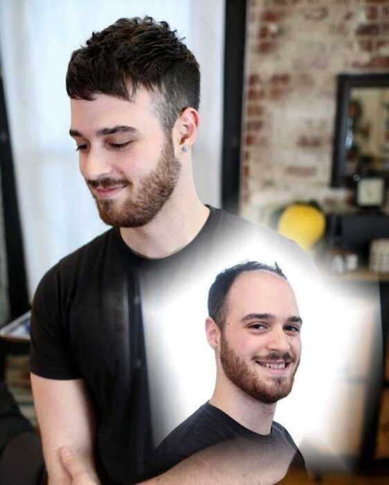 Парикмахер-волшебник превращает лысины мужчин в шикарные причёски