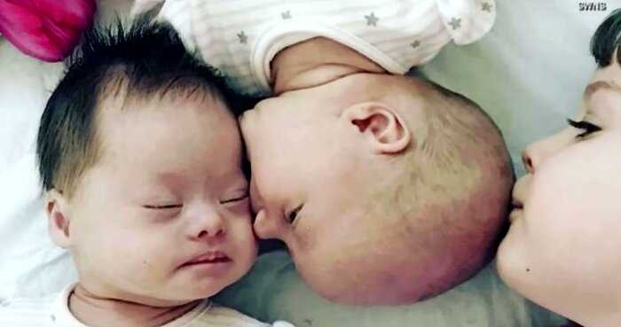 «Один шанс на миллион»: необыкновенные близнецы родились в британской семье