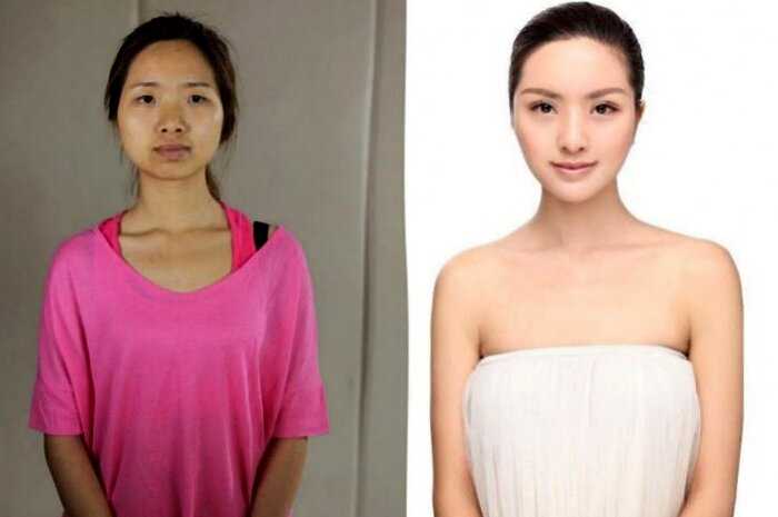 «С чистого лица»: 8 фото о том, как пластика меняет лица китаянок