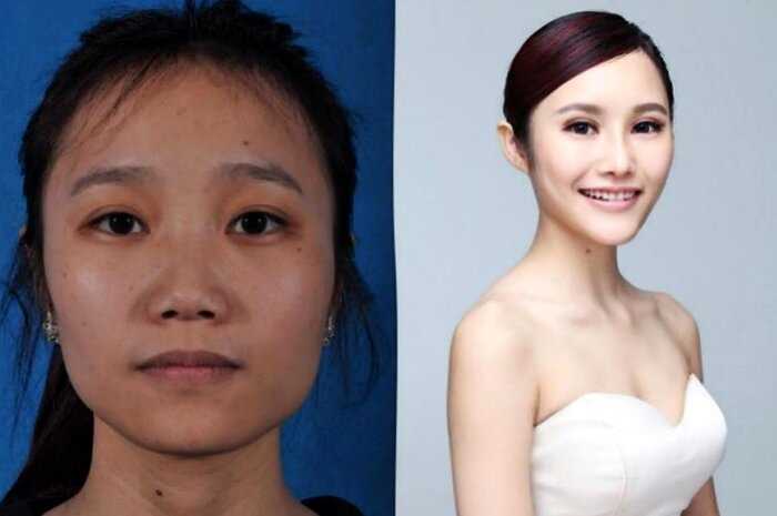 «С чистого лица»: 8 фото о том, как пластика меняет лица китаянок