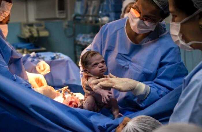 «Ты кто такой, дядя»: фото угрюмого новорожденного стало вирусным в сети
