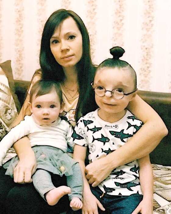 Москвичка усыновила малыша, которого никто не хотел, сделав его звездой соц-сетей