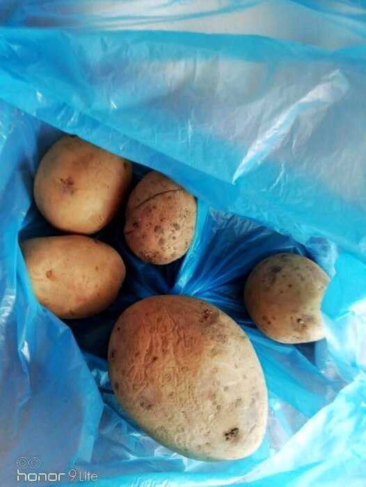 В Карелии детям-инвалидам выдали пару картофелин и 2 сосиски на карантин