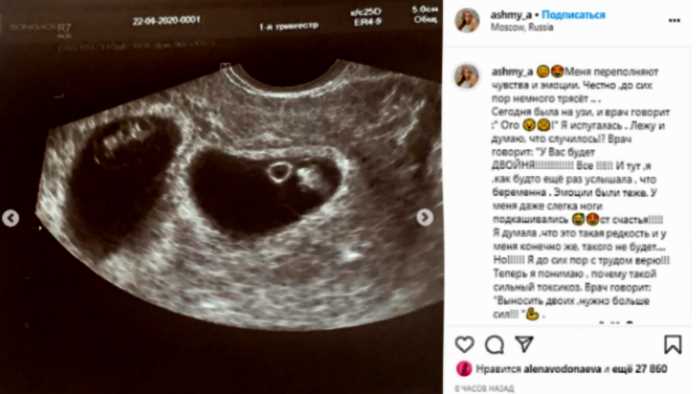 «До сих пор трясет»: экс-звезда «Дома-2» Алена Ашмарина беременна двойней