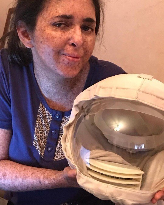 Из-за редкой аллергии на солнце женщина из Марокко ходит в скафандре